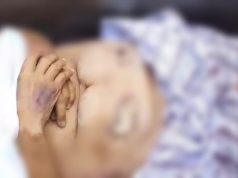 Misteri Kematian Pasien Usai Operasi di RS Hastin Karawang, Keluarga Temukan Kasa di Dalam Perut Usai Operasi, Pasien Temukan Luka Misterius dan Cairan Hitam dari Perut. (AlexaPodcast.ID)