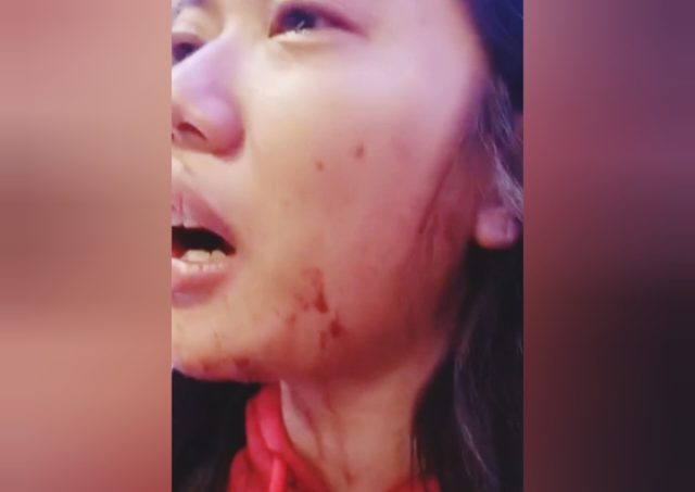 Perempuan Karawang Jadi Korban Penganiayaan WNA. (AlexaPodcast.ID)